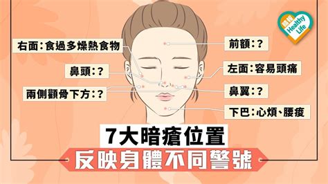 左邊面 暗瘡|【暗瘡位置】不同代表什麼？中醫教如何處理及預防